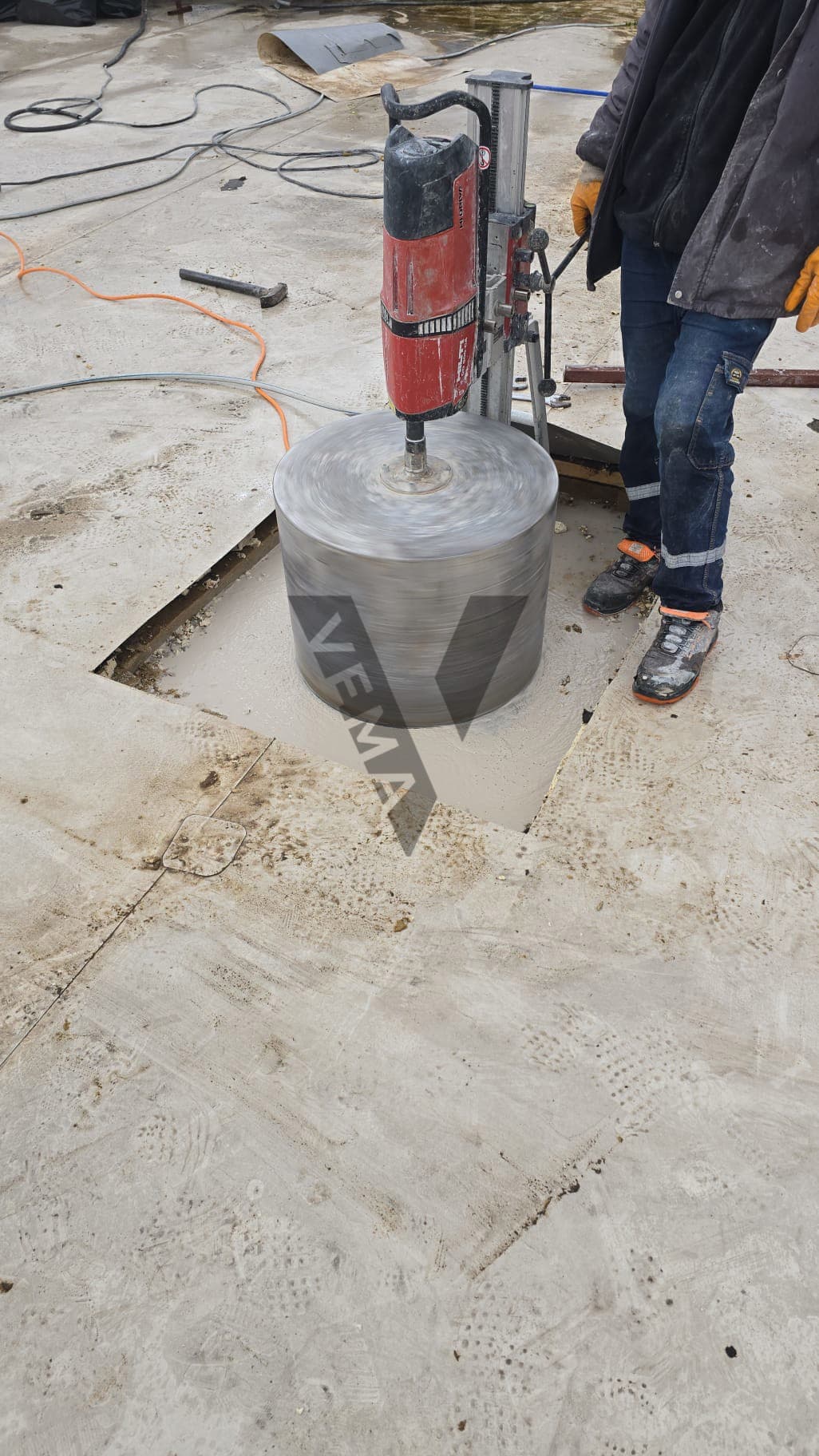 Kolon Mantolama Nedir? Nasıl Yapılır?